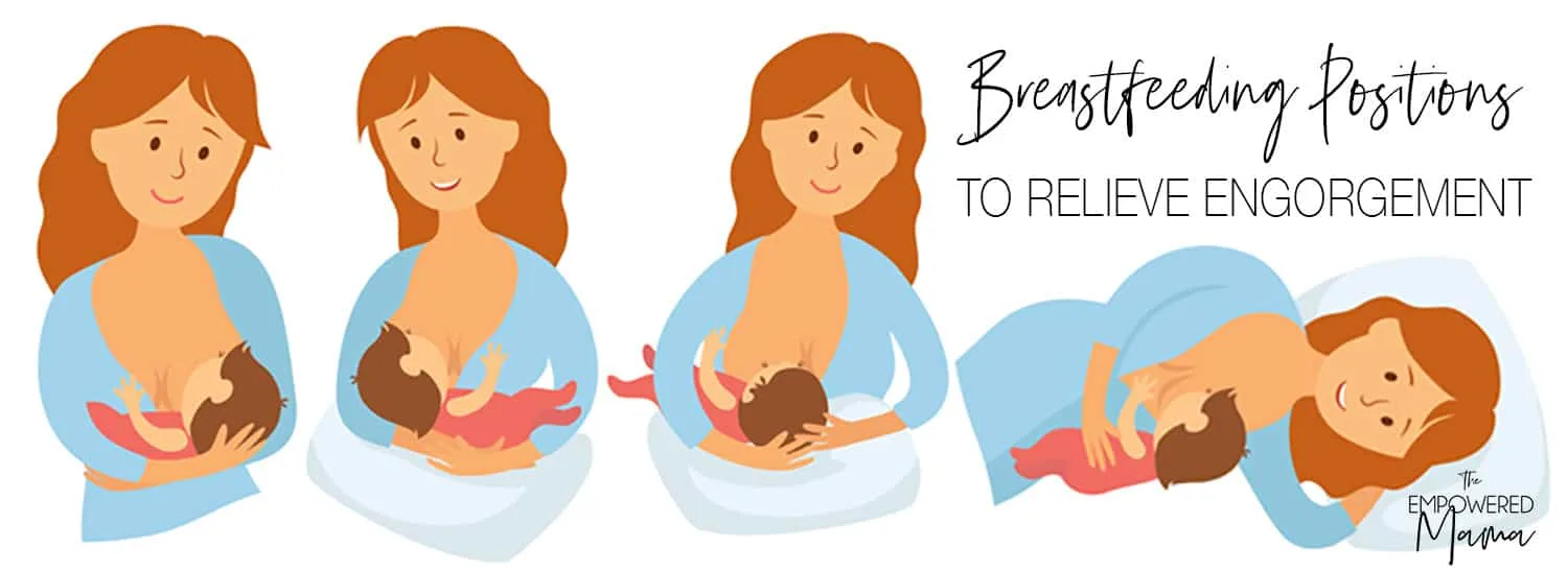 Try these breastfeeding positions to help relieve the pain of engorgement and help prevent breast engorgement. 